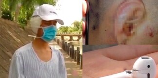 AirPods phát nổ ngay trên tai, một người đàn ông gặp thương tật nặng nhưng bất ngờ lại bị cả cộng đồng lên án