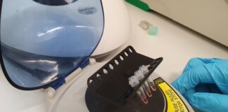 Anh đang phát triển một loại xét nghiệm Covid-19 nhanh và chính xác nhất thế giới, chỉ mất 30 phút và không có kết quả giả