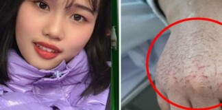 Bàn tay nứt nẻ, rớm máu của nữ y tá Vũ Hán và câu chuyện cảm động phía sau khiến ai cũng thán phục