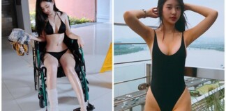 Bó bột, ngồi xe lăn nhưng vẫn mặc bikini gợi cảm, hot girl nóng bỏng khiến cả bệnh viện dậy sóng
