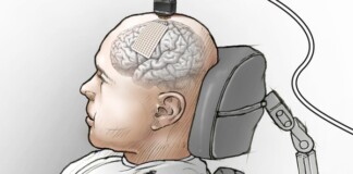 Các nhà khoa học nối não của một người câm với máy tính, và bây giờ anh ấy đã nói được