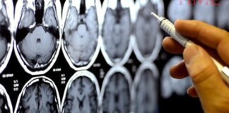 Càng hoạt động não bộ nhiều con người càng chết sớm, ít dùng não lại sống lâu