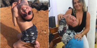 CĐM xôn xao trước anh chàng mắc bệnh lạ, mới sinh ra đã bị bác sĩ bảo không thể sống quá 24 tiếng nhưng nay đã 44 tuổi