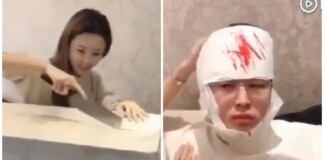 Chui vào thùng quà cho bạn gái bất ngờ, anh chàng đen đủi nhận cái kết đắng lòng, đầu khâu 20 mũi