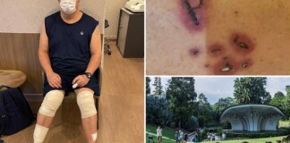 Đang tập thể dục thì bị 20 con rái cá truy sát đẫm máu, tốn 20 triệu viện phí bác sĩ còn bảo may mà không chết