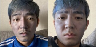 Dùng nhầm thuốc nhuộm tóc thay sữa rửa mặt, nam thanh niên đau xót khi bị cộng đồng mạng gọi là “Thanos đời thực”