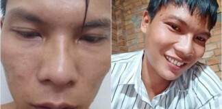 Được tặng tiền để làm thẩm mỹ, Lộc Fuho quyết tâm từ chối, bảo tồn nhan sắc