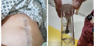 Ham vui theo trào lưu để làm clip TikTok, nam game thủ nuốt nhầm hạt nam châm vào dạ dày tới mức nguy kịch