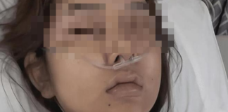 Nữ streamer bỏ hơn 8 tỷ cho giấc mơ nhan sắc để rồi nhận về bi kịch