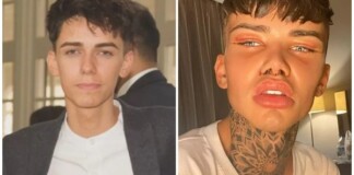 Tự thấy bản thân quá đẹp trai, anh chàng đầu tư gần 1 tỷ phẫu thuật cho “bớt bảnh bao”, CĐM chỉ biết lắc đầu ngán ngẩm