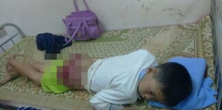 Xót xa bé 13 tuổi bị bố đánh bầm dập, mông rướm máu do bỏ học đi chơi điện tử